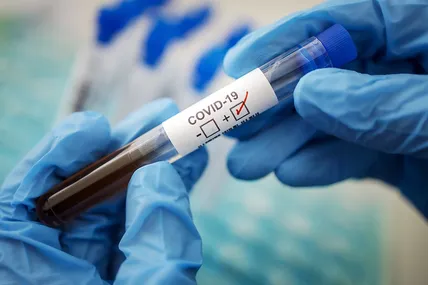 За добу 27 січня зафіксували рекордну кількість випадків COVID-19: понад 32 тисячі