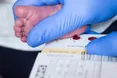 Загальний скринінг на СМА в Англії: після критики уряд погодився тестувати всіх немовлят