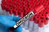 В Україні новий різновид «Омікрону»: ситуація на Львівщині
