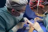Львівські лікарі прооперували жінку з невідомою хворобою, яка спричинила деформацію пальців