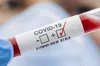 Кількість випадків COVID-19 на Львівщині зменшилась
