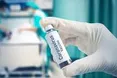 У ВООЗ спрогнозували, коли розпочнеться масова вакцинація від коронавірусу