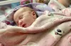 У Львові хірурги врятували немовля з вродженою вадою легень
