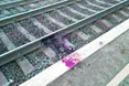 Втратив ноги через пакунок синові на війну