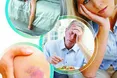 28 липня – Всесвітній день боротьби з вірусними гепатитами