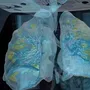 «Основна мішень коронавірусу — не легені»