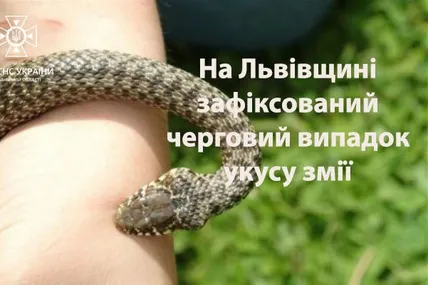 Укус змії. Фото: Головне управління ДСНС України у Львівській області