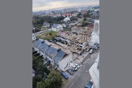 У Києві внаслідок російської комбінованої атаки рф постраждали 14 людей, один з них - у тяжкому стані. Також на Київщині зросла кількість постраждалих до 31 внаслідок масованої атаки росії