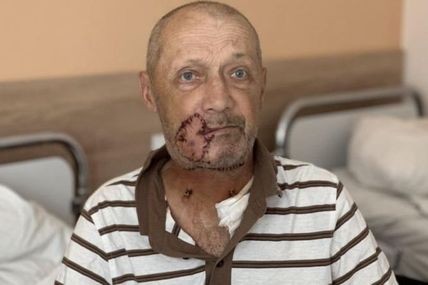 &laquo;Собака цілився зубами у шию&hellip;&raquo;