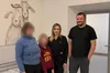 Хірурги львівського «Охматдиту» врятували обличчя 10-річному хлопчику після нещасного випадку на санках