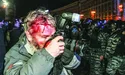 «Беркут» свідомо бив журналістів, щоб не було жахливих фото»