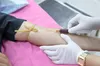 У Штатах схвалили перший аналіз крові на хворобу Альцгеймера: як це відбувається