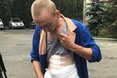На Львівщині бійцю-контрактнику відбили селезінку (оновлено)
