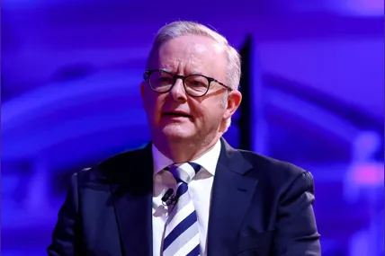 Anthony Albanese. Фото: Reuters