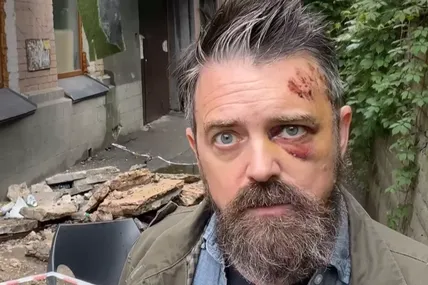 На американця, який приїхав до Києва документувати війну, обвалився балкон, – КМВА