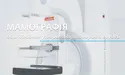 Мамографія у Львові: рання діагностика, що рятує життя
