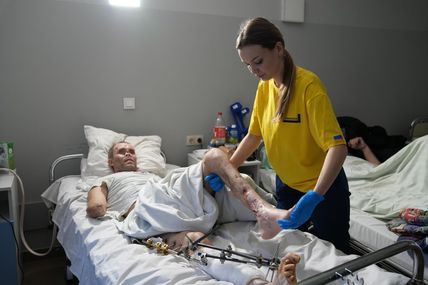 &laquo;Нас чекають 5 складних операцій на обличчі&raquo;