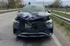 На Житомирщині нардеп на смерть збив людину