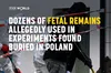 У Польщі на приватній ділянці знайшли десятки людських плодів: затримано патологоанатомку