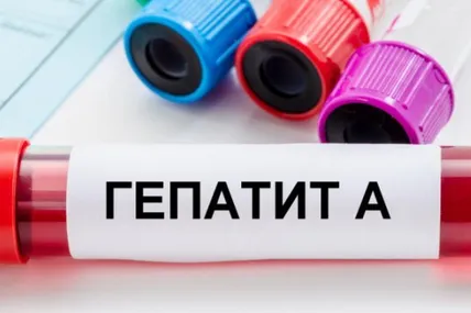 Фото умовне
