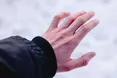 На Львівщині чоловік потрапив в лікарню через обмороження