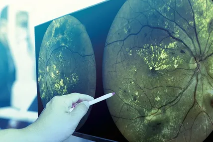Фото South Carolina Retina Institute.