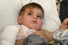 У Львові врятували дитину, яка отримала глибокі опіки від окропу