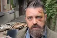 На американця, який приїхав до Києва документувати війну, обвалився балкон, — КМВА