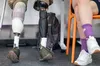 В Україні з’явиться польсько-український центр протезування для ветеранів