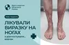 Вовчак маскувався під звичайну рану: львівські лікарі виявили небезпечну хворобу