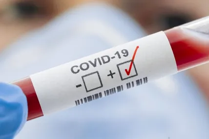 Кількість випадків COVID-19 на Львівщині зменшилась. Фото: Дрогобицька міська рада
